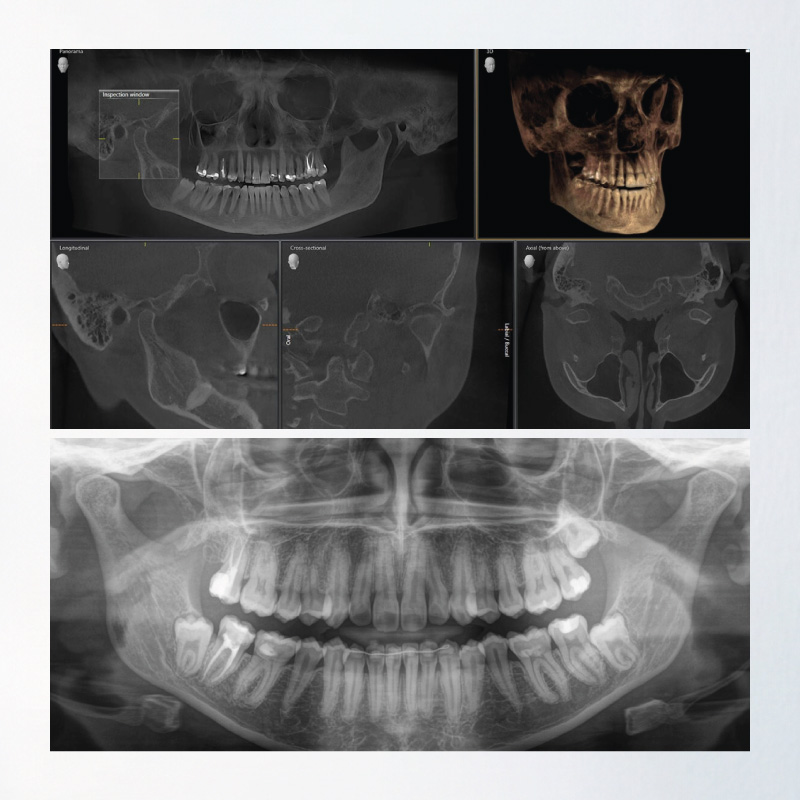 Axeos - Sistema de radiología 2D/3D