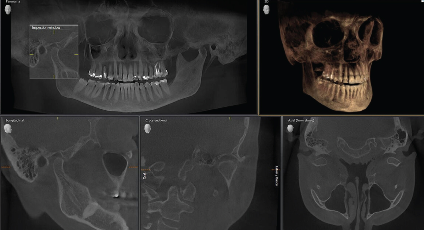 Axeos - Sistema de radiología 2D/3D
