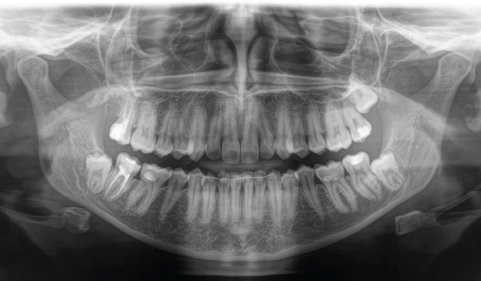 Axeos - Sistema de radiología 2D/3D