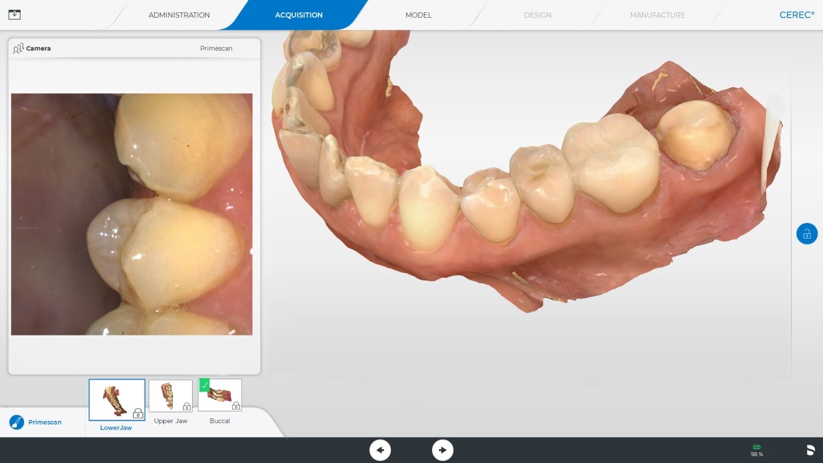CEREC Software