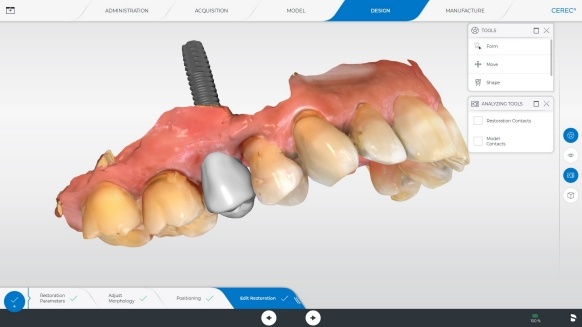 CEREC Software