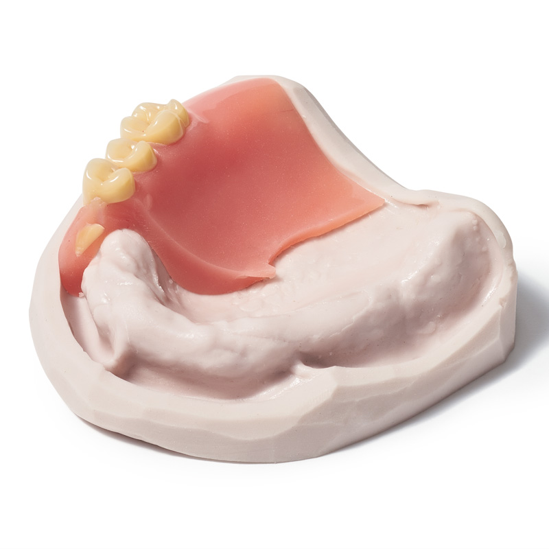 Zetalabor + Indurent gel
