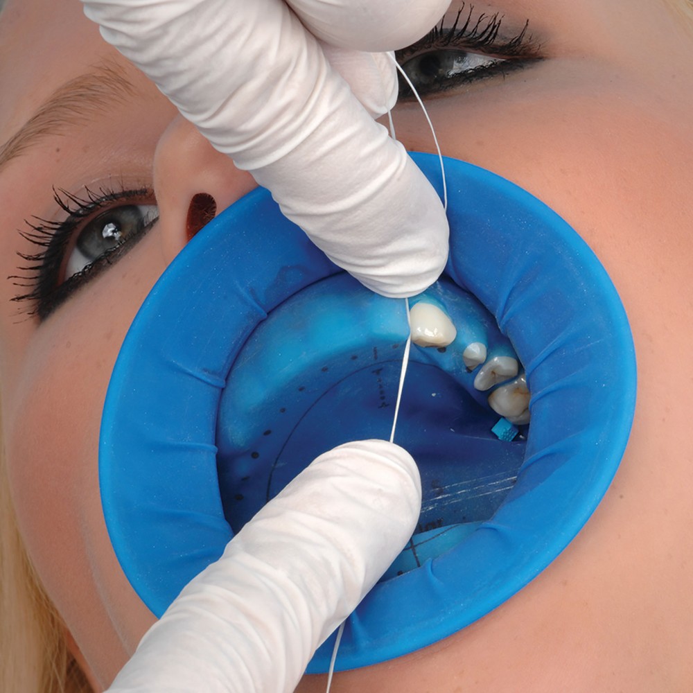 optradam